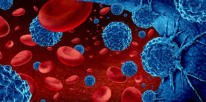 acute myeloid leukemia (AML) Medvitaz Pharma Solutions